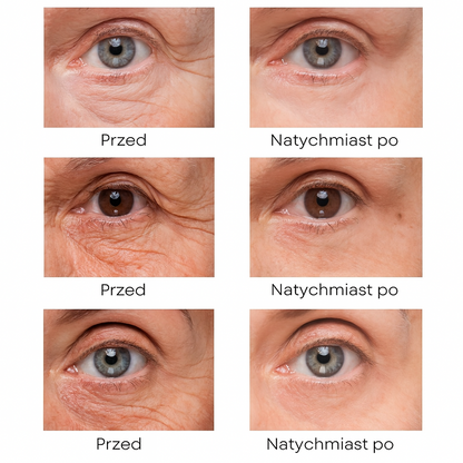 BrightUp™ – Eliminuje worki pod oczami i zmarszczki