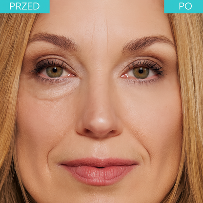 BrightUp™ – Eliminuje worki pod oczami i zmarszczki